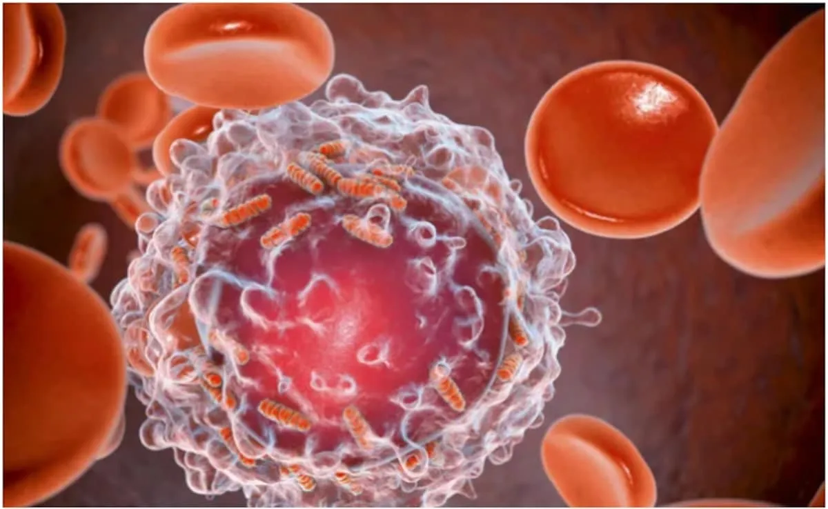 cancer cases, younger populations, lifestyle factors