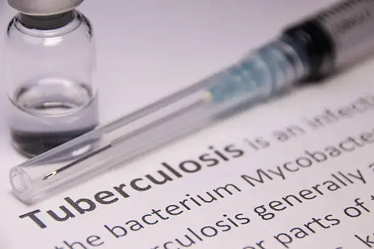 Tuberculosis detection device, Tezpur University, TB screening